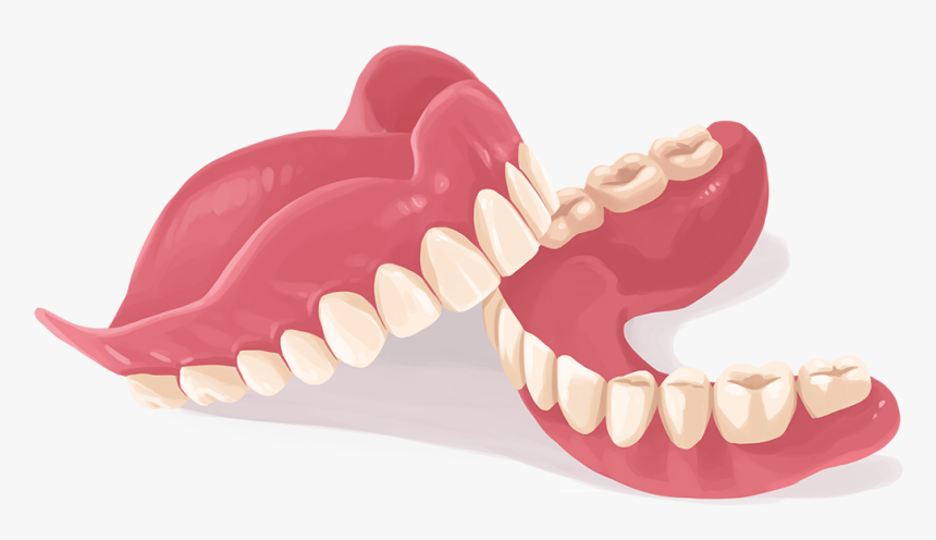 dentures with implants